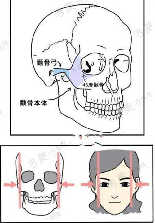 广州广大医院做正颌手术怎样预约之现场预约