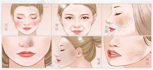谢宏彬拉皮手术口碑：患者真实反馈