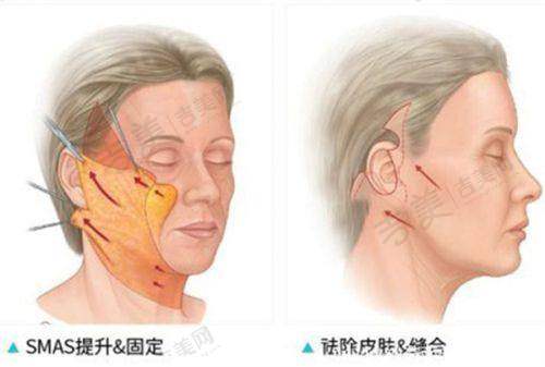 广州广大医院做正颌手术怎样预约之在线官网预约