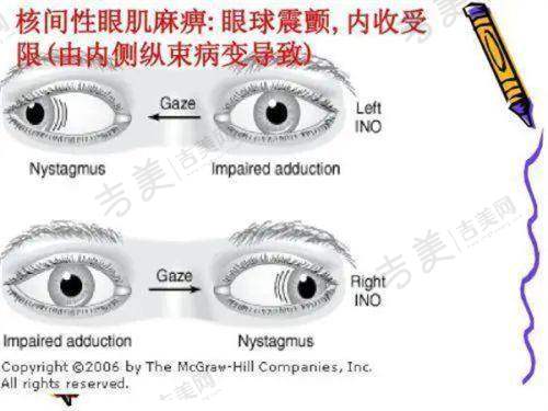 张家界近视手术、全飞秒近视手术价格及爱尔眼科近视手术价格优势如何？有口碑评价与真人案例揭秘