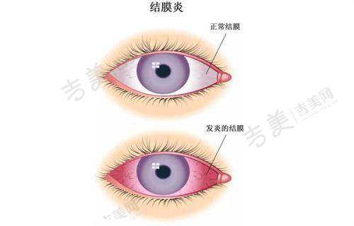 西安市第四 医院眼科24小时急诊服务包括什么？