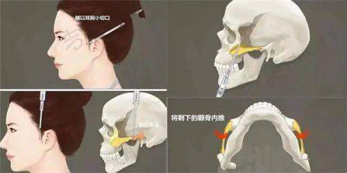 南通去疤痕哪家医院好？专注皮肤医美门诊