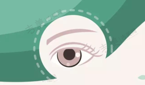 张家界近视手术价格相关：儿童近视防控手术价格