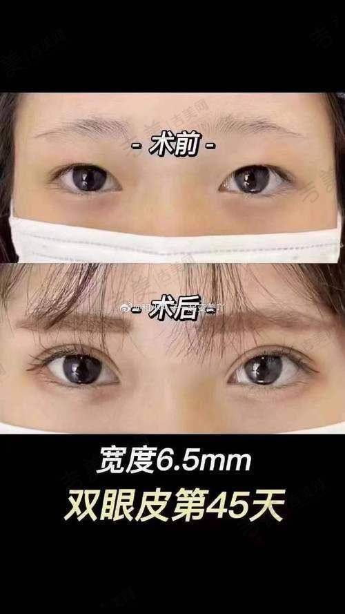 方贤成医生独特的技术优势
