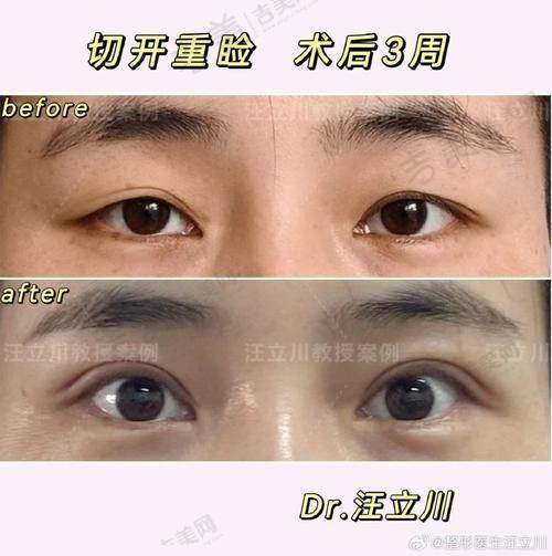 方贤成医生擅长的广泛整形项目