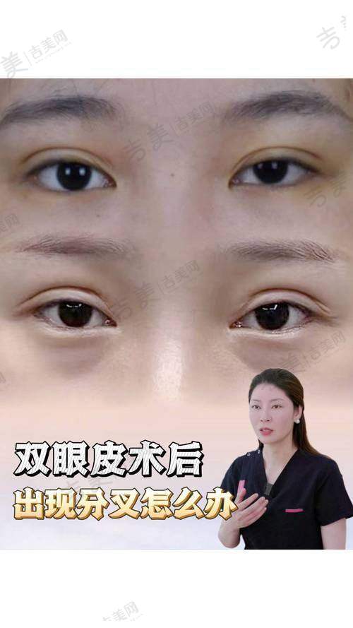 叶明龙医生的顾客真实好评展示