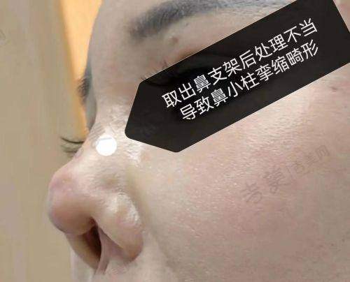 谭琳琳医生顾客好评分享
