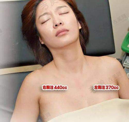 张国军 医生的技术优势