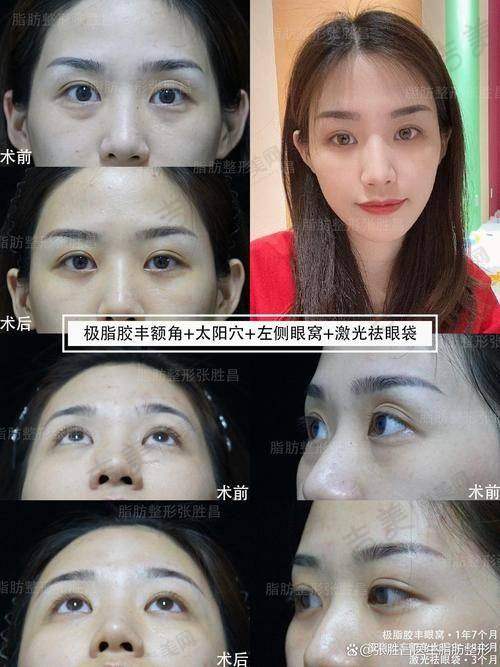 唐继元医生擅长的整形项目