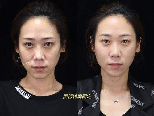 张俊医生坐诊的太原时光整形美容医院详情