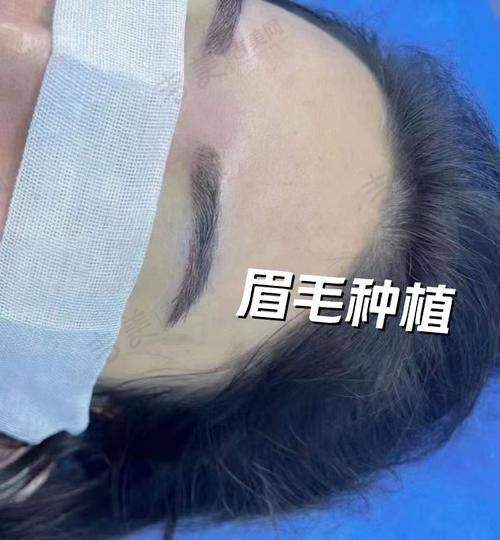 西安逆时光医疗美容医院地址及乘车路线