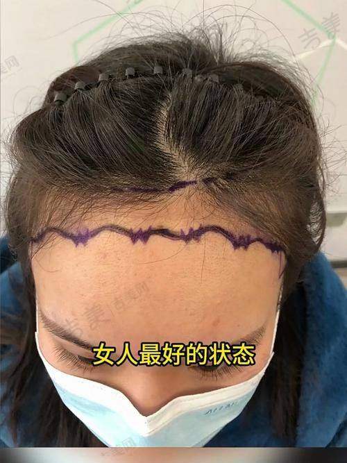 桂林时光医学美容门诊部口碑好不好？附真实患者口碑评价