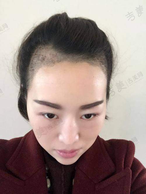 西安逆时光医疗美容医院怎么样,口碑评价如何