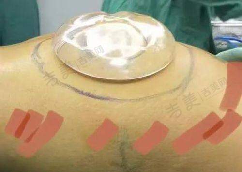 桂林时光医学美容门诊部怎么样，口碑评价如何？