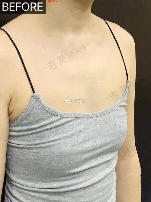 李继先医生的个人资料亮点