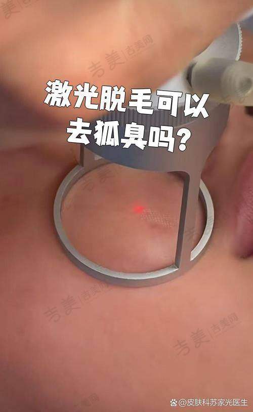 惠州时光医疗美容门诊部怎么样，口碑评价如何