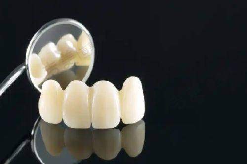 深圳德艺口腔诊所怎么样价格贵吗之网友种植牙评价