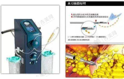 分享我在广州健丽去眼袋的经历:术前准备工作全揭秘