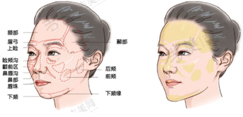 分享我在广州健丽去眼袋的经历:术后成效显著令人惊喜