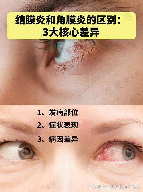 呼和浩特新视界眼科医院眼科口碑好不好？附真实患者口碑评价