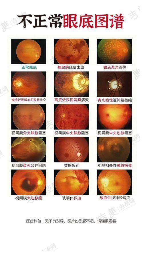 呼和浩特市第一医院眼科项目特色
