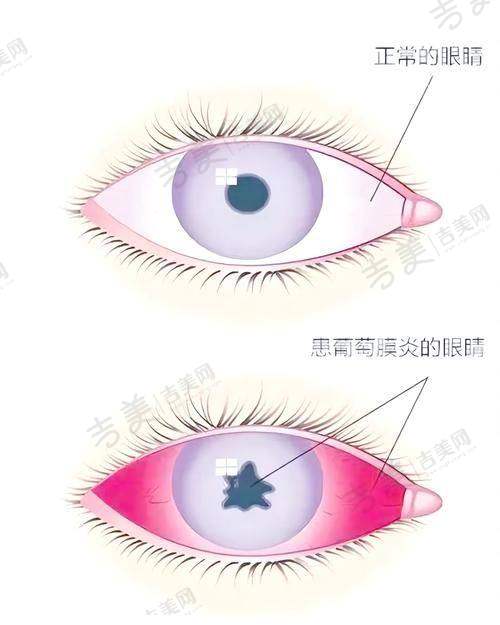 内蒙古科技大学包头医学校第一附属医院眼科口碑好不好？附真实患者口碑评价