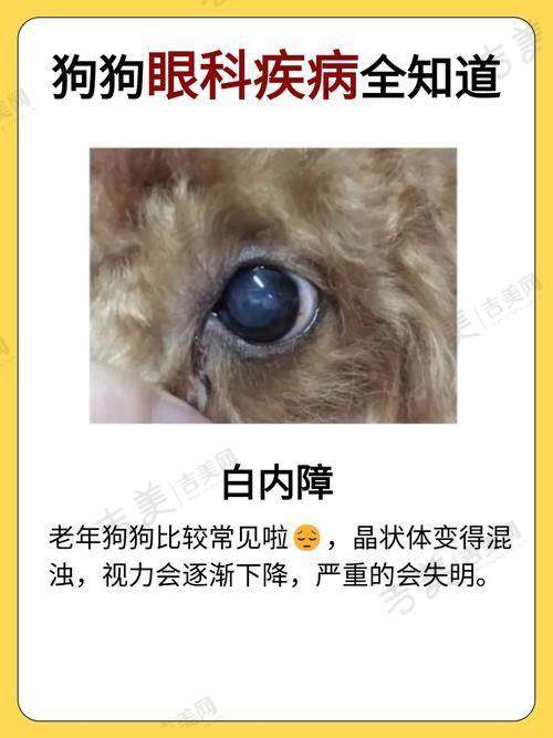 内蒙古自治区妇幼保健院眼科项目特色
