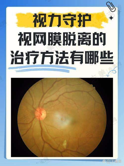 内蒙古自治区中医医院眼科口碑好不好?附真实患者口碑评价