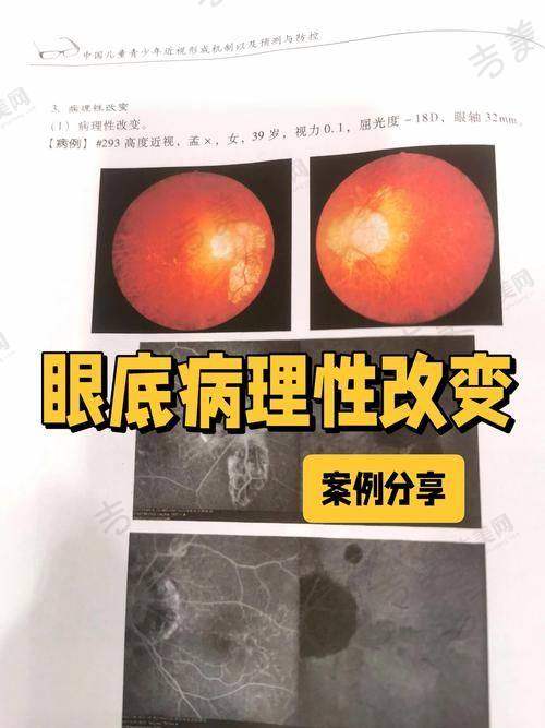 包头市第四 医院眼科医生简介