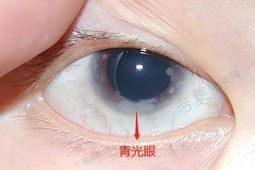 呼和浩特市第一医院眼科口碑好不好？附真实患者口碑评价