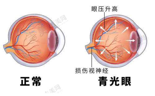 包头市中 心医院眼科价格表