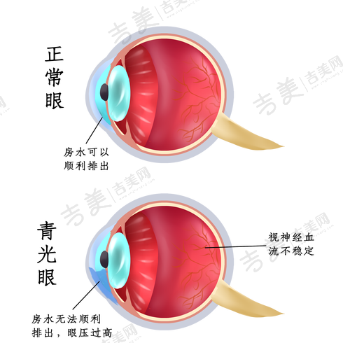 包头朝聚眼科医院眼科价格表