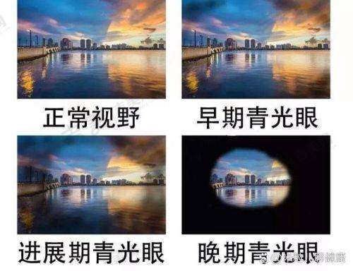 内蒙古包钢医院眼科口碑好不好？附真实患者口碑评价