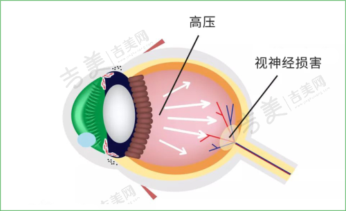 内蒙古一机医院眼科项目特色