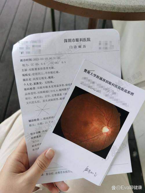 内蒙古医 科 大学附属医院眼科项目特色