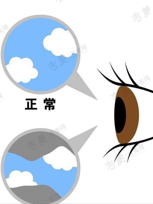 包头朝聚眼科医院眼科地址及乘车路线