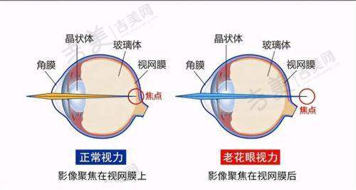 内蒙古科技大学包头医学校第一附属医院眼科地址及乘车路线