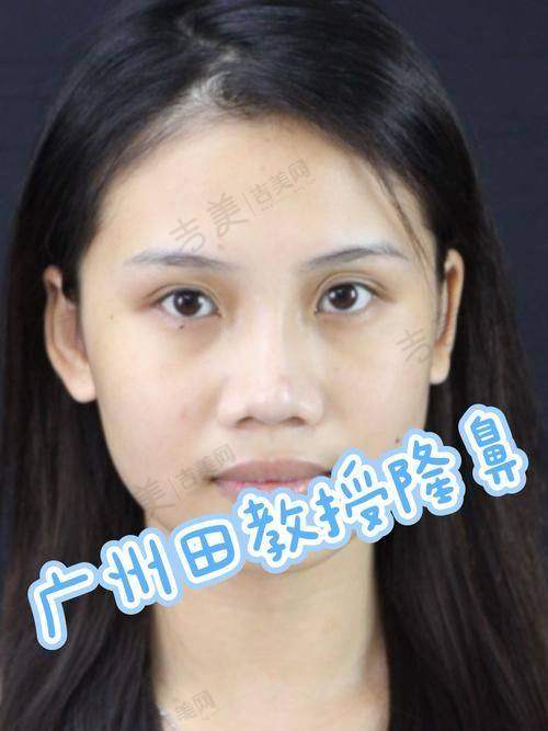 樊雯君医生执医荣誉展示