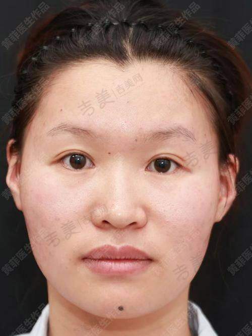 赵静梅医生口碑评价及反馈内容:患者高度认可的真实见证