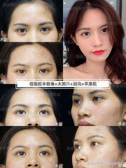 赵静梅医生个人资料简介:26 年整形生涯的深厚积淀