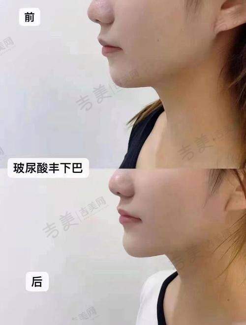 赵静梅医生顾客好评:变得更美体验的真情分享