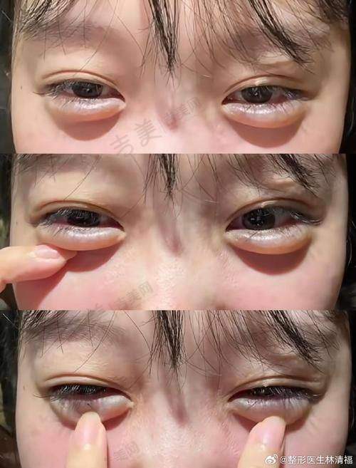 郑胜医生坐诊的重庆星荣整形外科医院详情