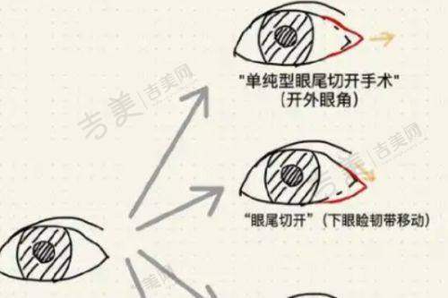 2025年深圳鹏程医院疤痕科全新价格表曝光：激光清洗各类色斑费用