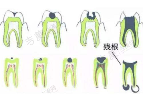 2025年深圳鹏程医院疤痕科全新价格表曝光：注射淡疤收费标准