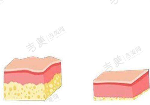 深圳名丽医疗美容医院眼部整形技术好不好