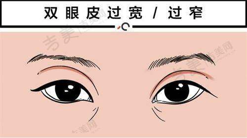 武汉八爪鱼紧缩术哪家医院做的好之选择医院的温馨提示