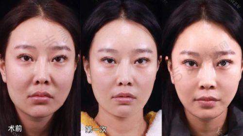 四、湘西赫美医疗美容怎么样之医院特色项目