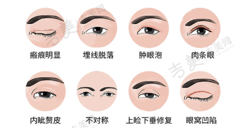 重庆做吸脂比较好的医生大盘点之王棚医生