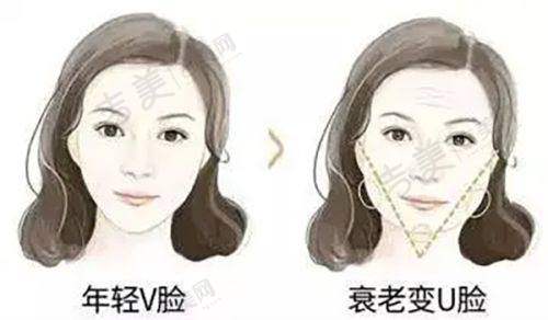 重庆做吸脂比较好的医生大盘点之宋建星医生