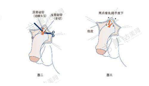 成都素美是正规整形医院吗?医生实力为其正名